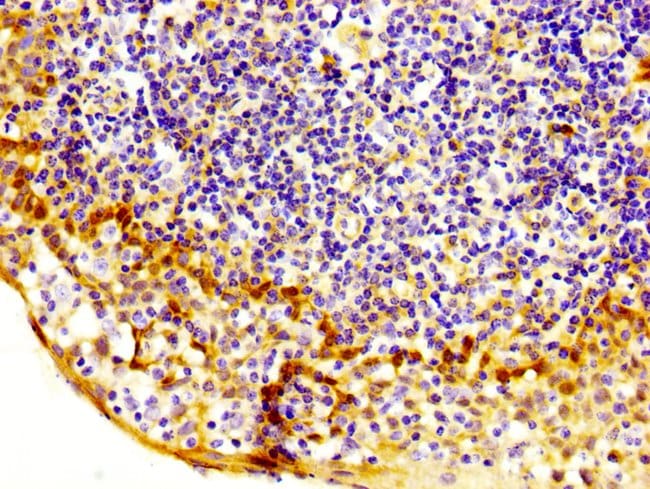100UG MASTL ANTIBODY 100 ug