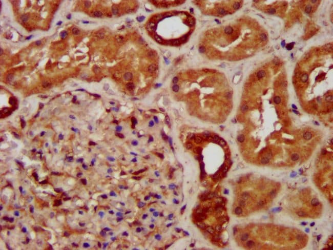 100UG SUCLG2 ANTIBODY 100 ug