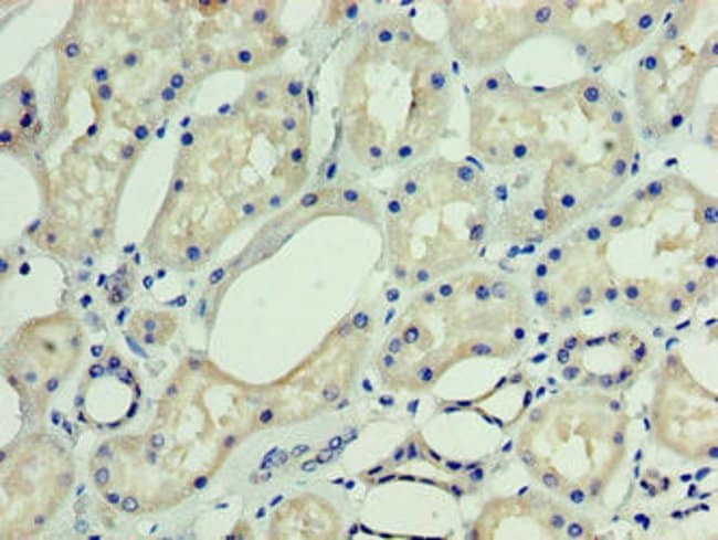 100UG DNAJC30 ANTIBODY 100 ug
