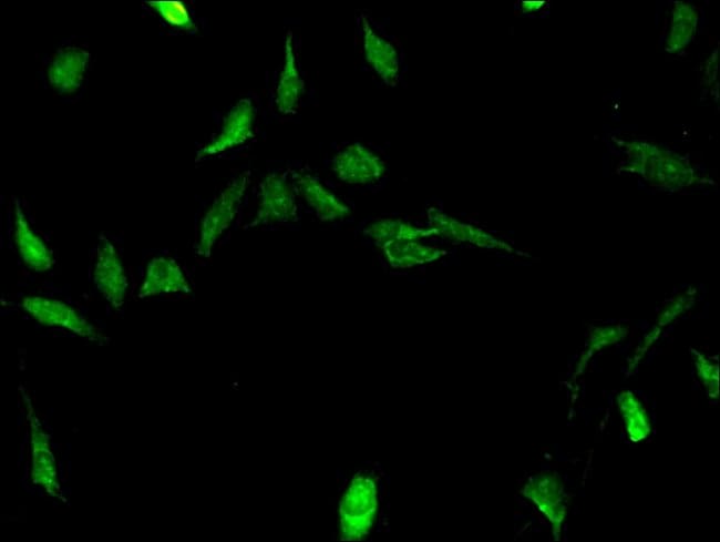 100UG STRBP ANTIBODY 100 ug