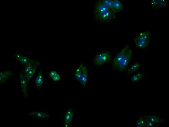 100UG LASS5 ANTIBODY 100 ug