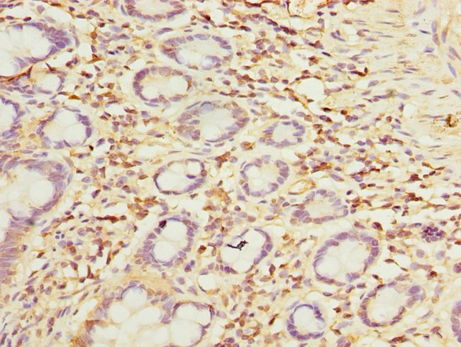 100UG OTUD6B ANTIBODY 100 ug