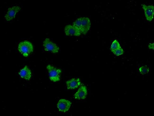 100UL LRTM2 ANTIBODY 100 ul