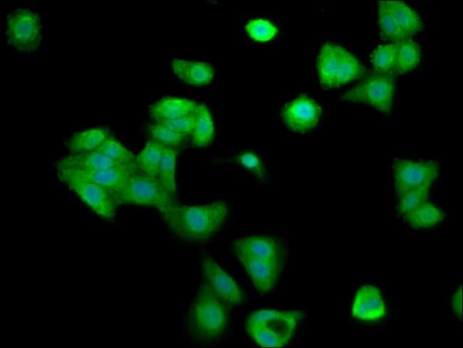 100UG CYCLIN Y ANTIBODY 100 ug