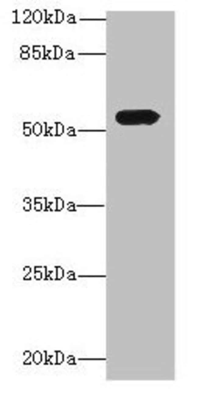 100UG ICA1L ANTIBODY 100 ug