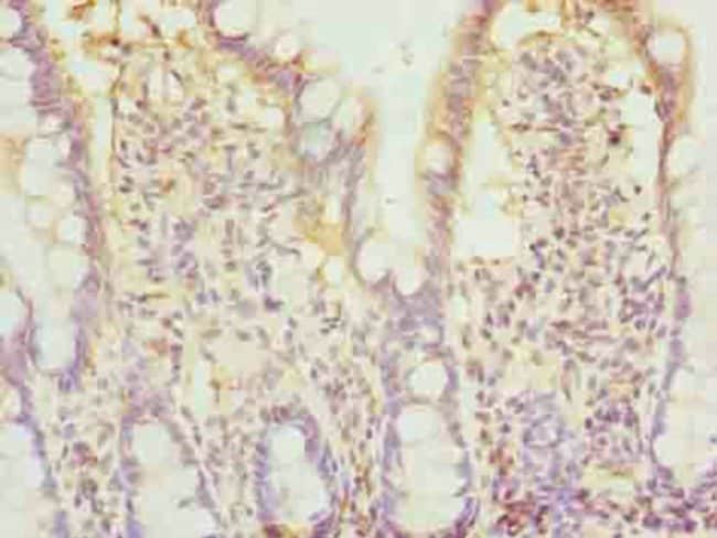 100UG BTN2A2 ANTIBODY 100 ug