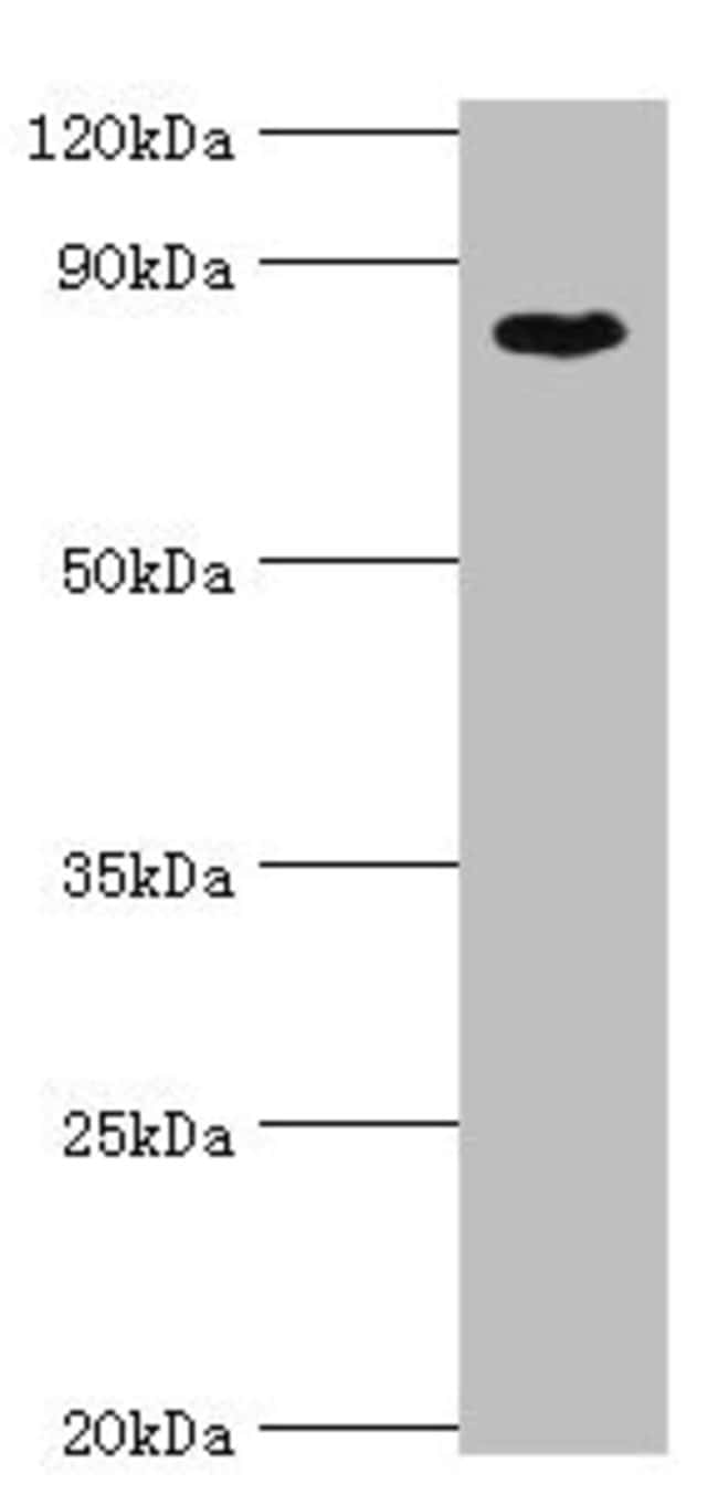 100UL BAP1 ANTIBODY 100 ul