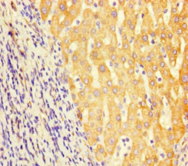 100UG GCDH ANTIBODY 100 ug