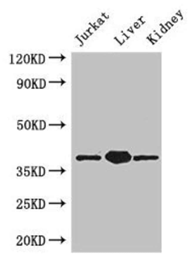 100UG PINX1 ANTIBODY 100 ug