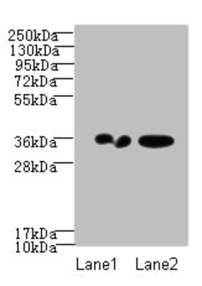 100UG RPRD1A ANTIBODY 100 ug