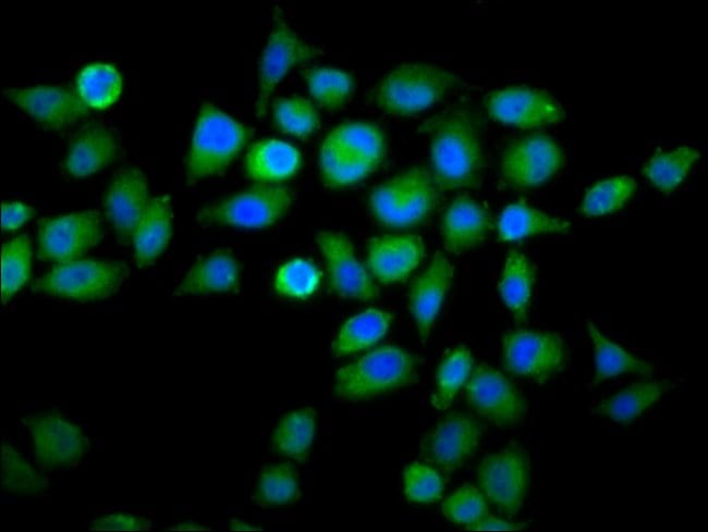100UG WDFY2 ANTIBODY 100 ug