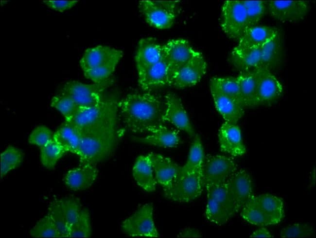100UG NEDD4L ANTIBODY 100 ug