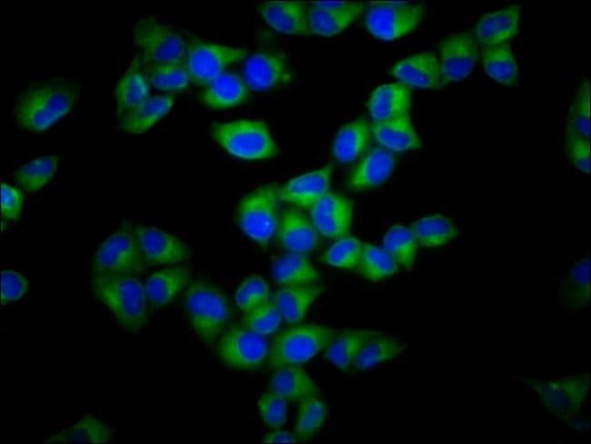 100UG GSDMA ANTIBODY 100 ug