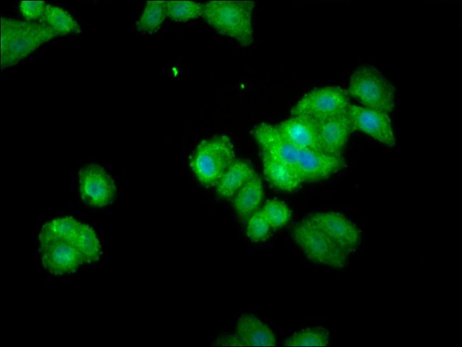 100UG THEMIS ANTIBODY 100 ug