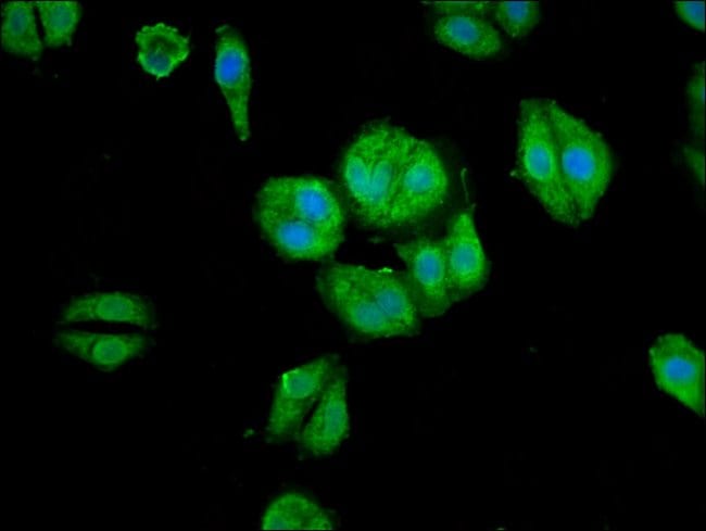100UG ARHGAP18 ANTIBODY 100 ug