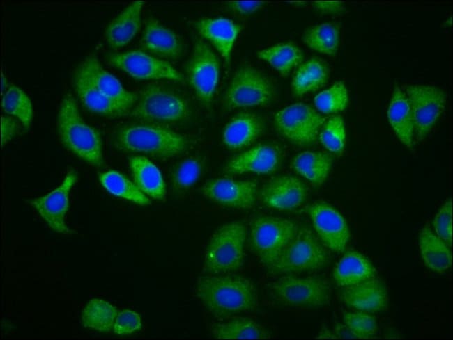100UG MFSD4 ANTIBODY 100 ug