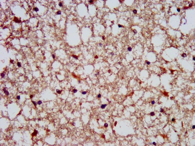 100UG SLAIN1 ANTIBODY 100 ug