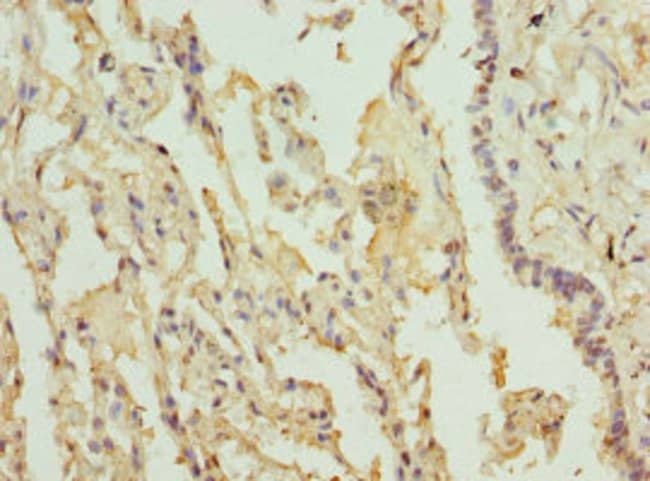 100UL LILRB4 ANTIBODY 100 ul