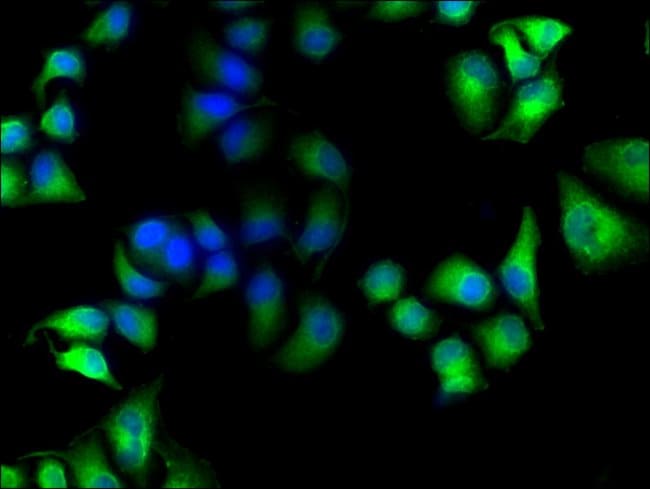 100UL MICAL1 ANTIBODY 100 ul
