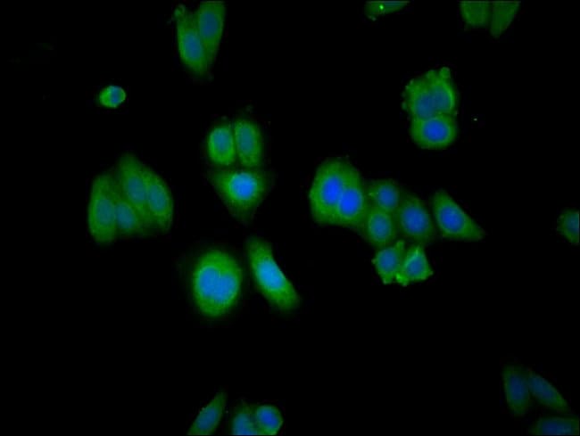 100UG RABGGTA ANTIBODY 100 ug