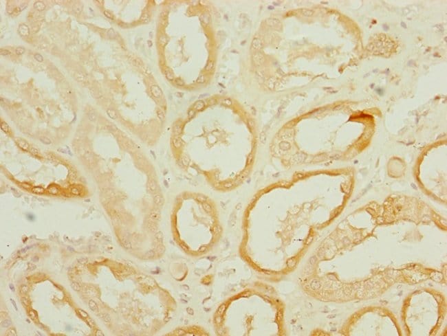 100UL DNAJC19 ANTIBODY 100 ul