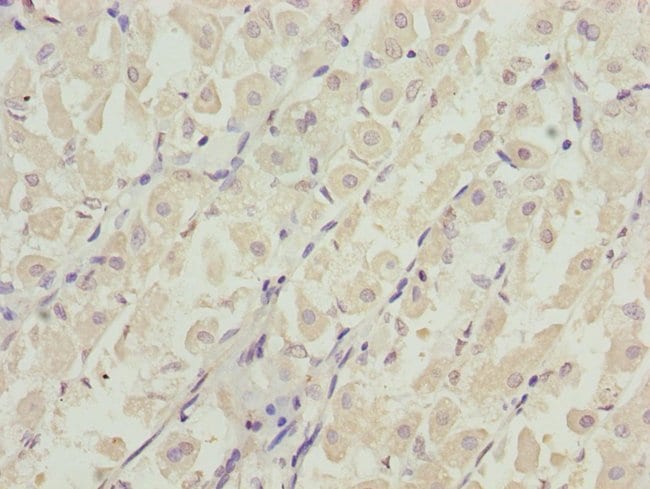 100UL DDX11 ANTIBODY 100 ul