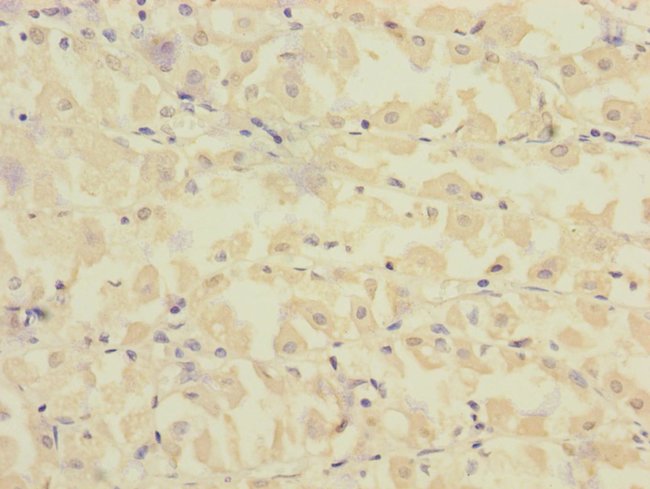 100UL FCRL2 ANTIBODY 100 ul