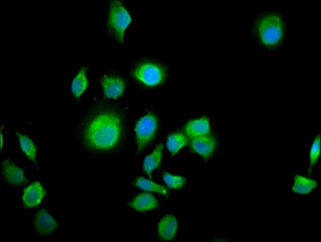 100UG ALS2CR12 ANTIBODY 100 ug