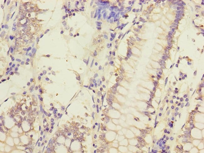 100UL MCCC1 ANTIBODY 100 ul