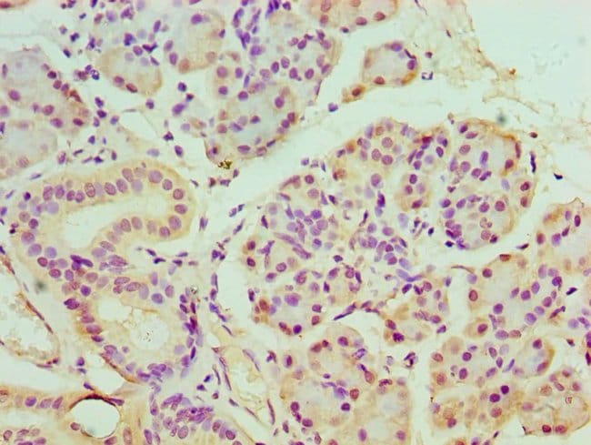 100UL BANP ANTIBODY 100 ul