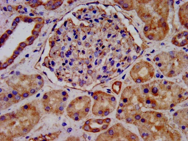 100UG LEMD2 ANTIBODY 100 ug