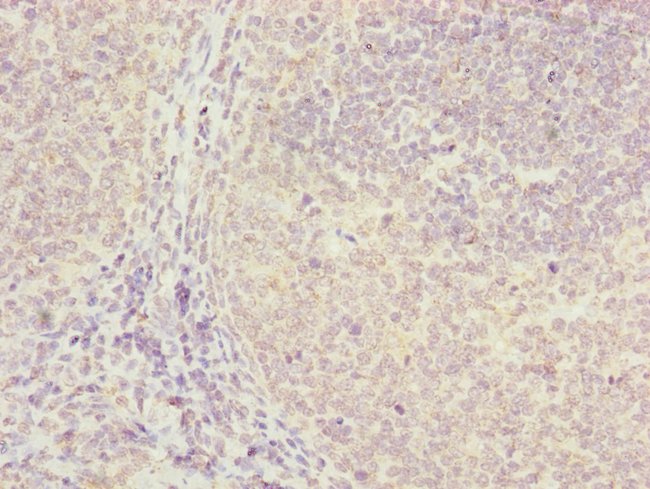 100UL FBXO22 ANTIBODY 100 ul