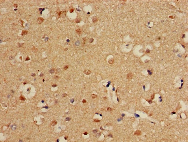 100UG CPT1C ANTIBODY 100 ug