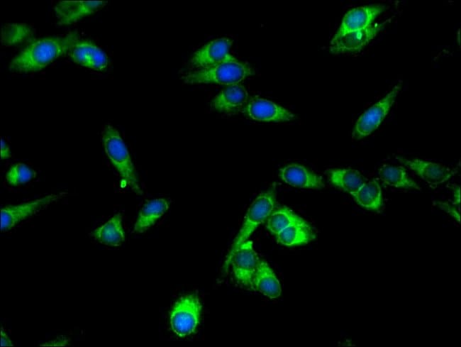 100UG SPPL2A ANTIBODY 100 ug