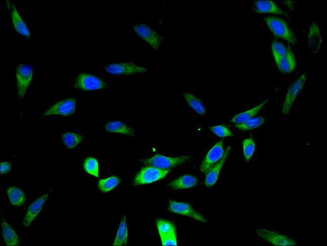 100UG DYX1C1 ANTIBODY 100 ug