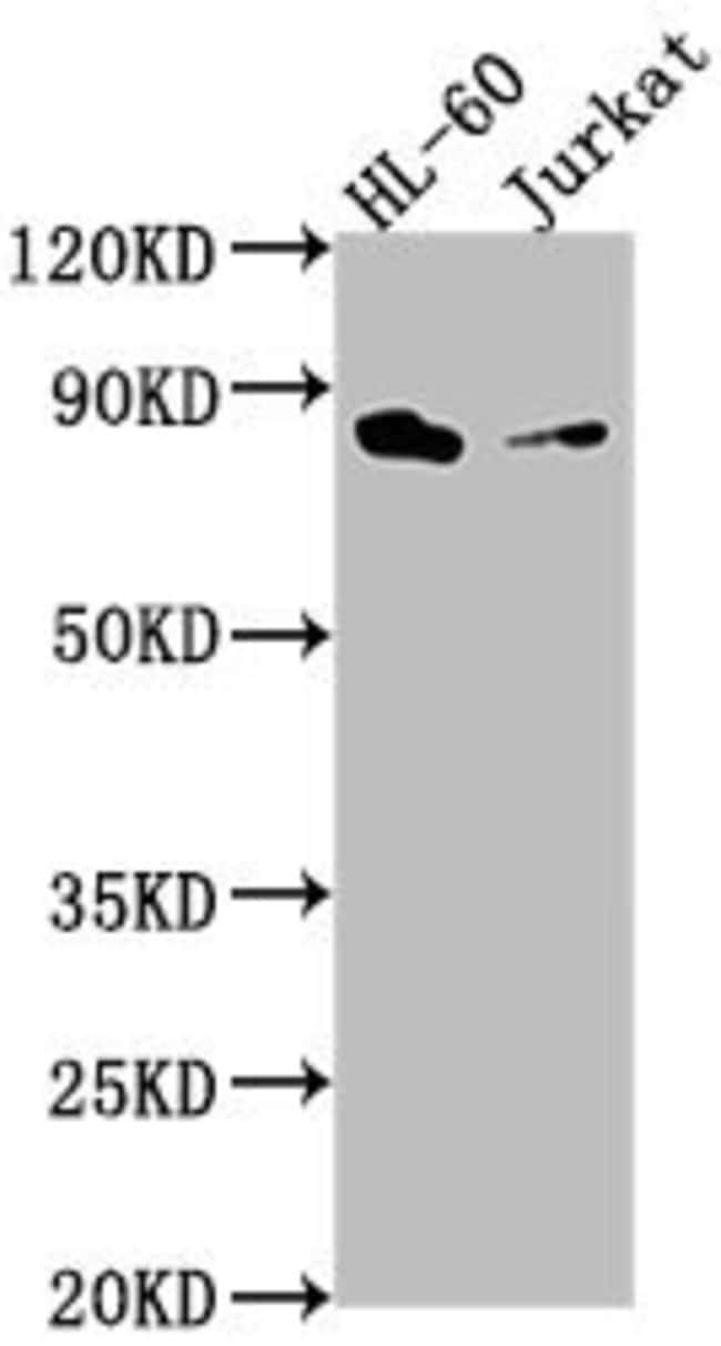 100UL ELMO1 ANTIBODY 100 ul