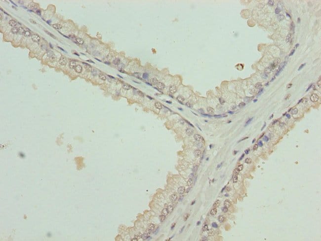 100UG CYTOKERATIN 35 ANTIBODY 100 ug