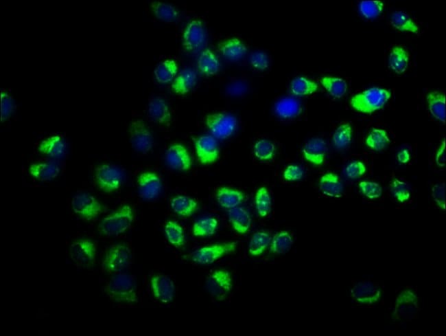 100UG SLCO2A1 ANTIBODY 100 ug
