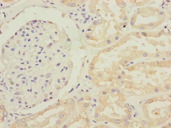 100UL GFM2 ANTIBODY 100 ul