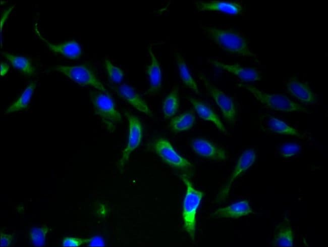 100UG SLC25A46 ANTIBODY 100 ug