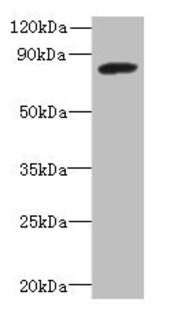 100UG PBXIP1 ANTIBODY 100 ug