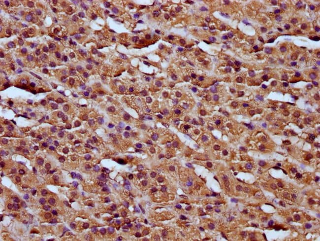 100UG RCN3 ANTIBODY 100 ug