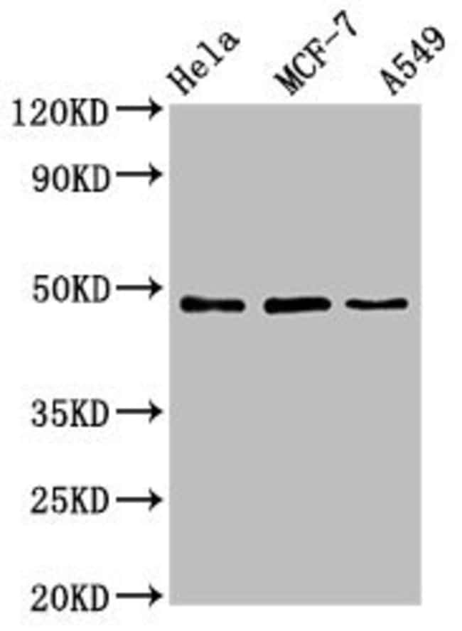 100UG LCOR ANTIBODY 100 ug