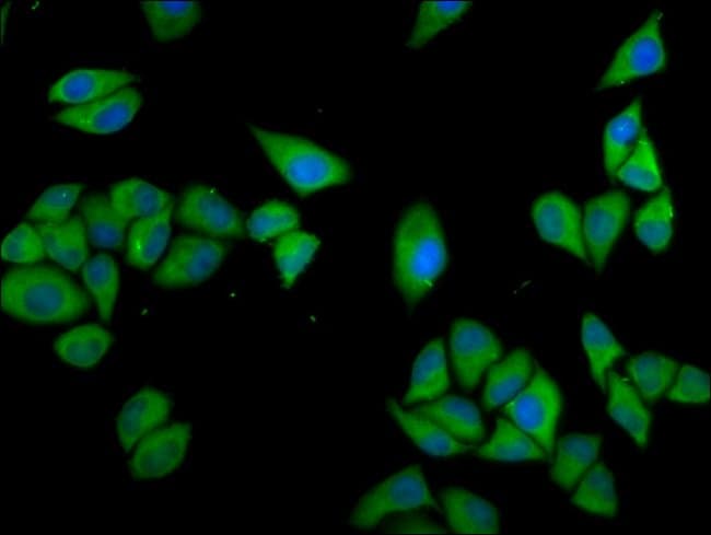 100UG CLCC1 ANTIBODY 100 ug