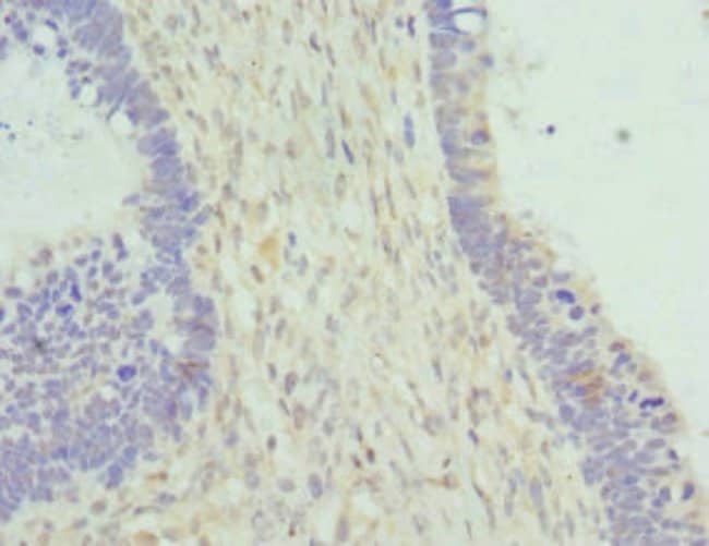 100UL CYTOHESIN 2 ANTIBODY 100 ul