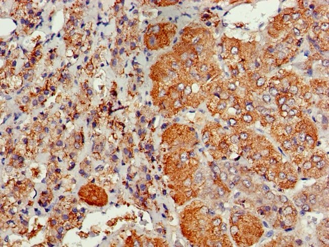 100UG CDC6 ANTIBODY 100 ug