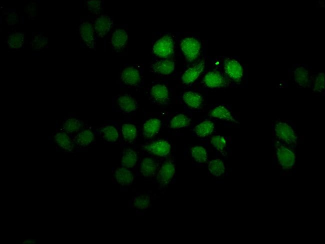 100UG FEV ANTIBODY 100 ug
