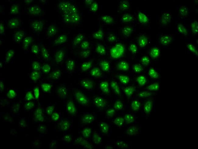 100UG TSNAX ANTIBODY 100 ug