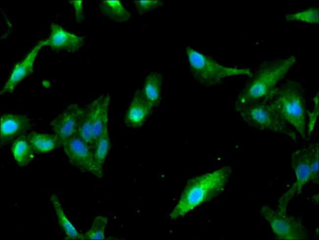 100UG PAIP2 ANTIBODY 100 ug