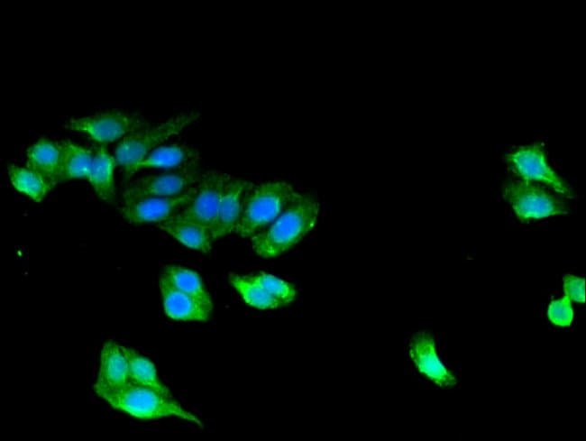 100UG STAC ANTIBODY 100 ug